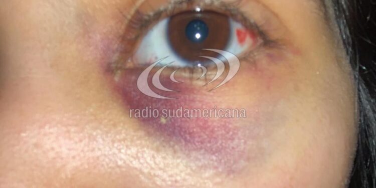 CORRIENTES CAPITAL: Denunció que su compañera la noqueó en el patio de la Escuela