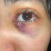 CORRIENTES CAPITAL: Denunció que su compañera la noqueó en el patio de la Escuela