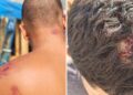 Amnistía Internacional denuncia “tortura y tratos crueles” de militares españoles a los migrantes en Ceuta: “Cuando terminaron, me tiraron por un terraplén”