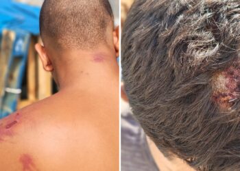 Amnistía Internacional denuncia “tortura y tratos crueles” de militares españoles a los migrantes en Ceuta: “Cuando terminaron, me tiraron por un terraplén”