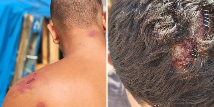 Amnistía Internacional denuncia “tortura y tratos crueles” de militares españoles a los migrantes en Ceuta: “Cuando terminaron, me tiraron por un terraplén”