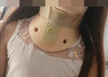 Iba en moto por la vereda, atropelló a una nena de 8 años que salía de su casa y escapó: la policía busca identificar por las cámaras al agresor