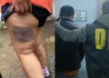 TENÍA DENUNCIAS POR VIOLENCIA DE GÉNERO: Atacó a su ex pareja con un garrote y fue detenido en Chaco