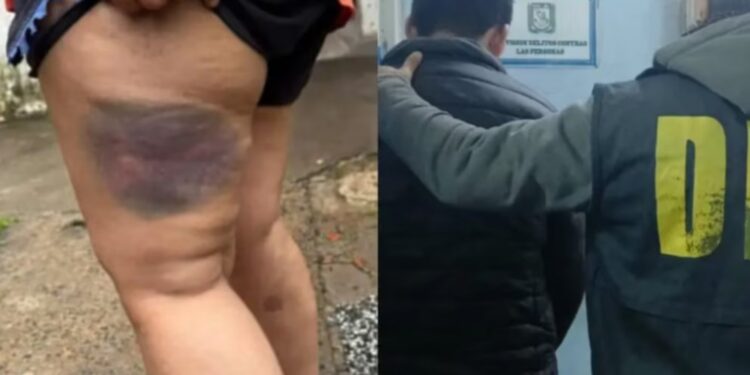 TENÍA DENUNCIAS POR VIOLENCIA DE GÉNERO: Atacó a su ex pareja con un garrote y fue detenido en Chaco