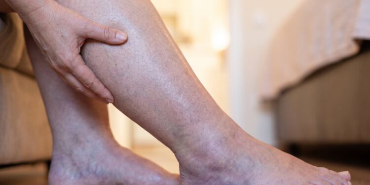 Una pierna inflamada, falta de aire o dolor en el pecho: los síntomas que pueden indicar una trombosis y exigen atención urgente