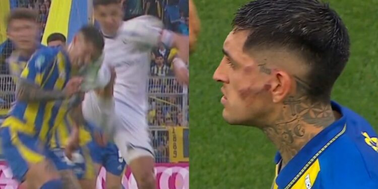 Tras la patada de Álex Arce, Gastón Ávila debió ser trasladado a un sanatorio: el comunicado de Rosario Central